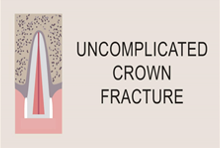 Uncomplicated crown fracture
