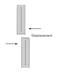 An image of a displacement fracture