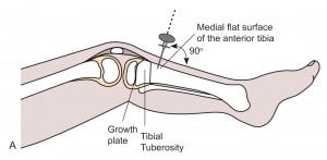 Intraosseous access of tibia anatomy 