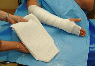 Below elbow slab and above elbow slab plaster